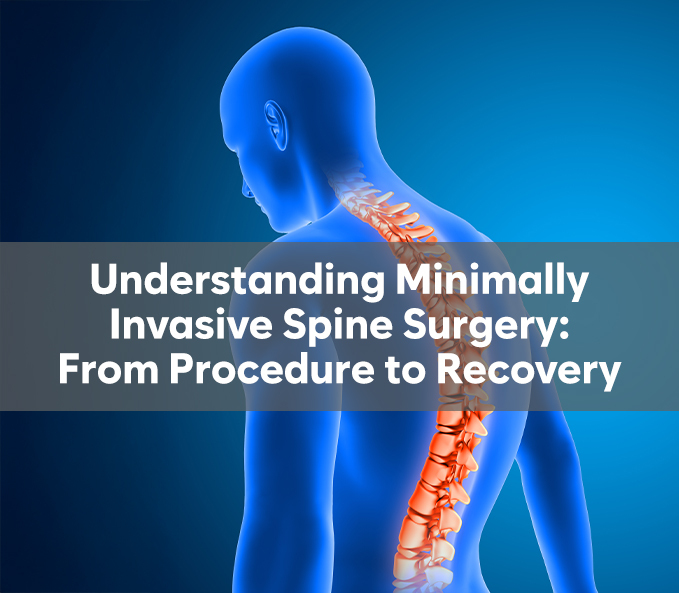 Understanding Minimally Invasive Spine Surgery: From Procedure to Recovery