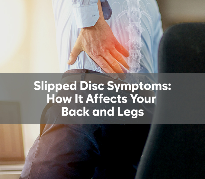 Slipped Disc Symptoms