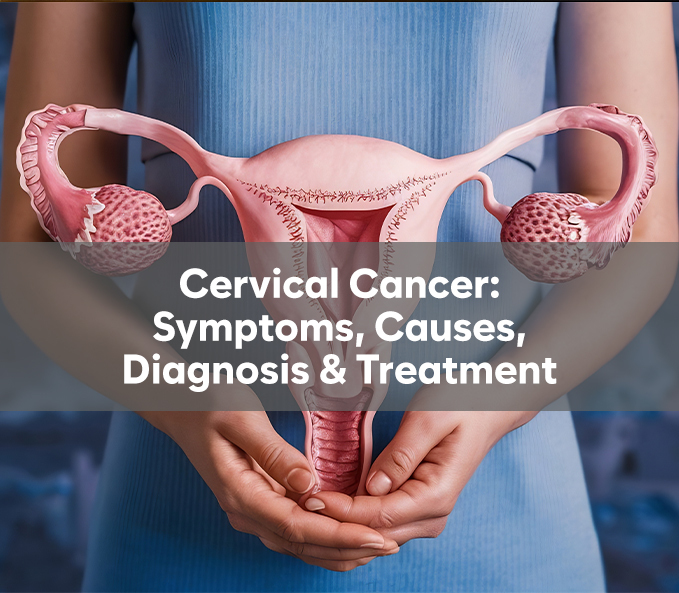 Cervical Cancer
