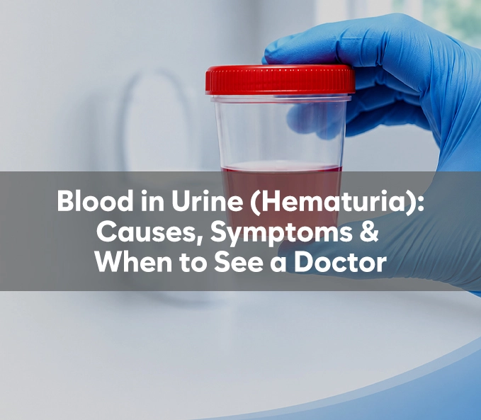 Blood in Urine (Hematuria): Causes, Symptoms & When to See a Doctor