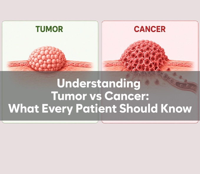 Understanding Tumor vs. Cancer