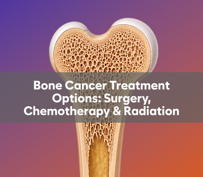 Bone Cancer Treatment Options: Surgery, Chemotherapy & Radiation