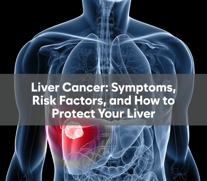 Liver Cancer: Symptoms, Risk Factors, and How to Protect Your Liver