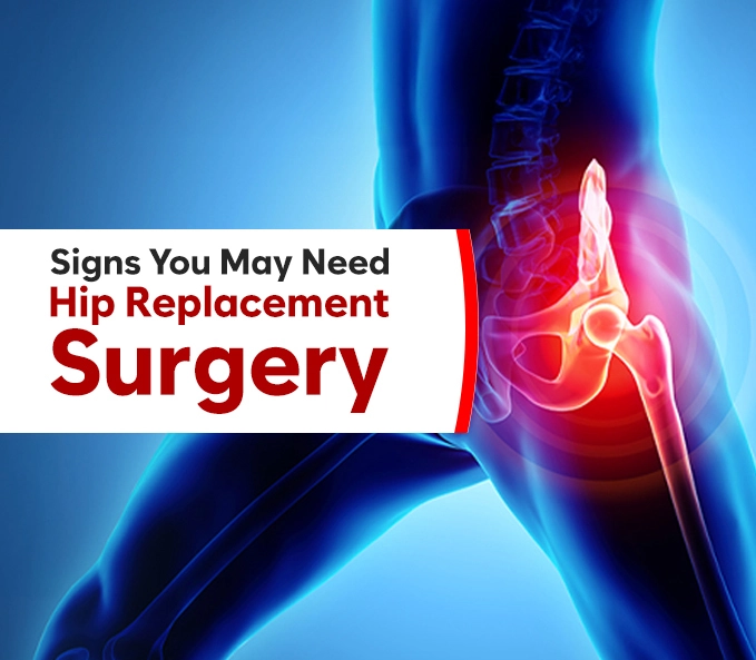 Signs You May Need Hip Replacement Surgery