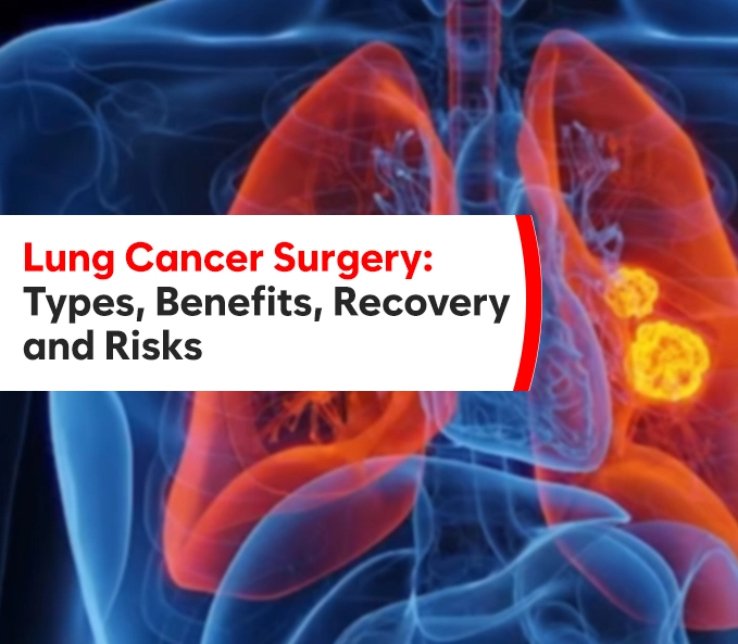 Lung Cancer Surgery: Types, Benefits, Recovery, and Risks