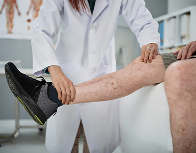 Varicose Veins Screening in Nashik - UMC Hospitals