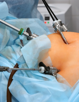 Bariatric Surgery